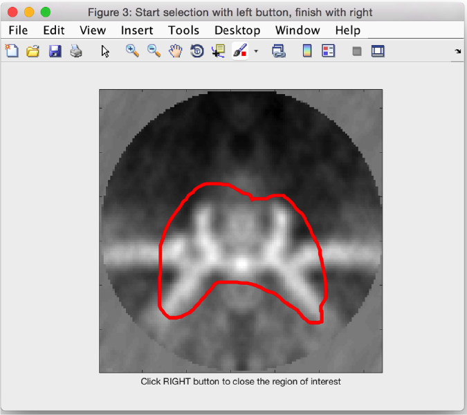 File:Fhv3dHanddraw.png