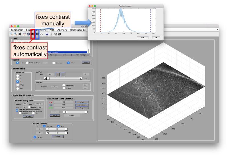 File:FhvTomosliceContrast.png