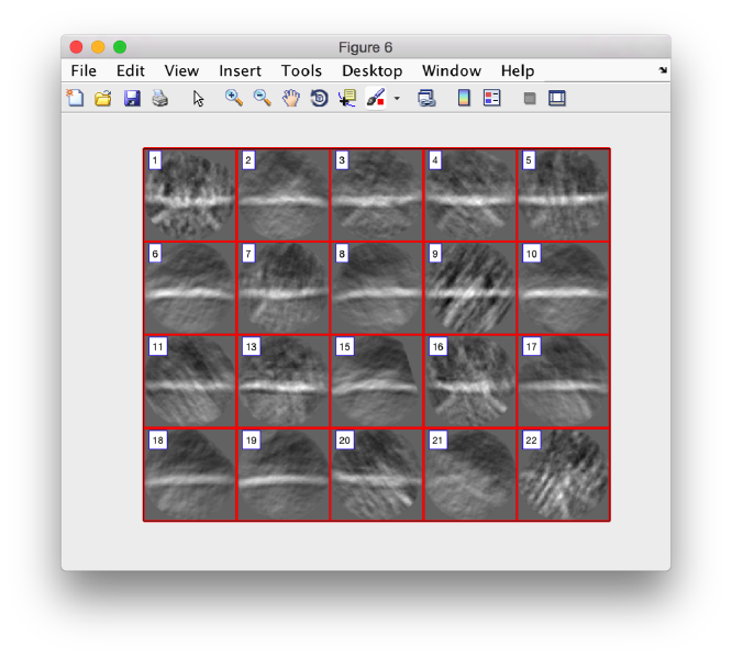 File:FhvOrientedSlicesX.png