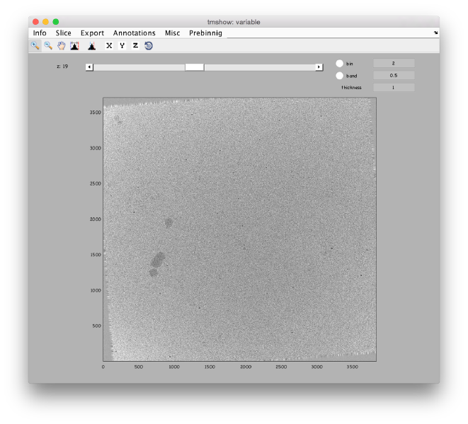 File:LocalizedProjectionDtmshow.png