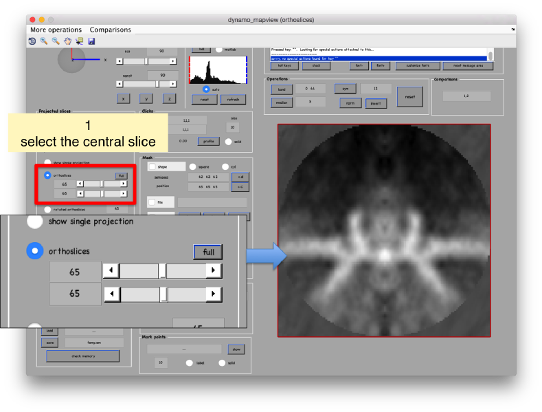 File:Fhv3dMapviewCentralSlice.png
