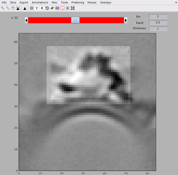 File:Retromer template with mask.png