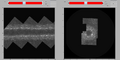 ROI berofe and after recentering.png