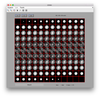 FhvMembraneMissingRandomized.png