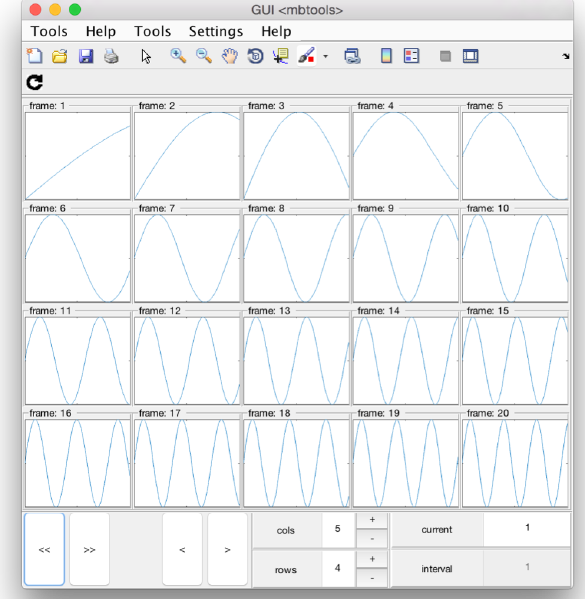 File:CustomVideoMontageSinuses.png
